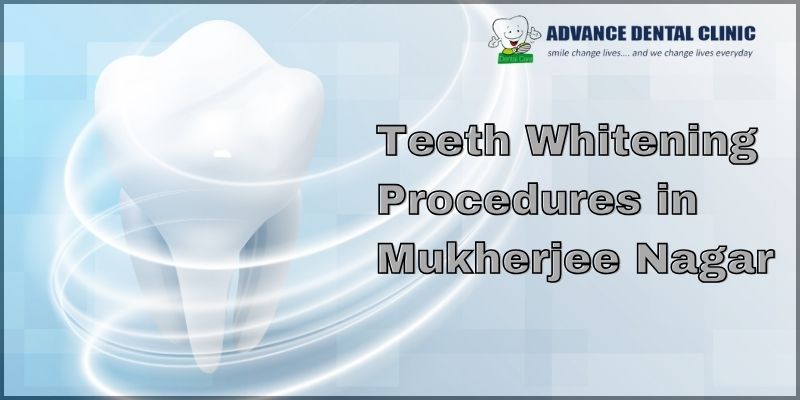 Teeth Whitening Procedures In Mukherjee Nagar